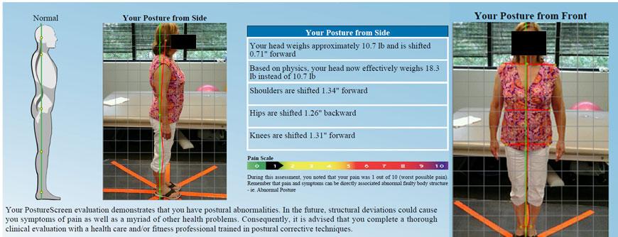 Free Consultation And Posture Screening Medical Fitness And Wellness Group